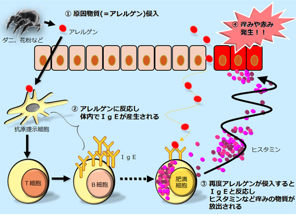 ①アレルゲンが体内に侵入⇒②アレルゲンに反応し体内でIgEが産生される⇒③再度アレルゲンが侵入するとIgEと反応しヒスタミンなど痒みの物質が放出される⇒④痒みや赤み発生！！